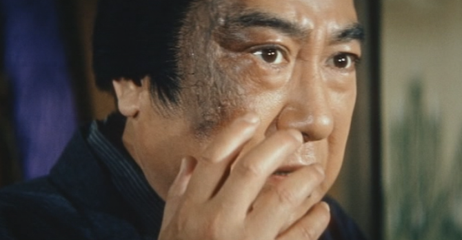 A facially disfigured Japanese man in feudal clothes looks at something with horror, while touching his face with his fingers